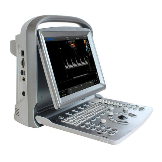 CHISON ECO5 Ultrasound Machine with Color Doppler + convex transducer Medvana UK
