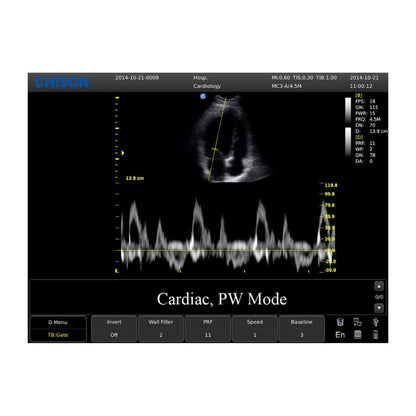 CHISON ECO3 Expert Ultrasound Machine with convex transducer (C3-A) Medvana UK