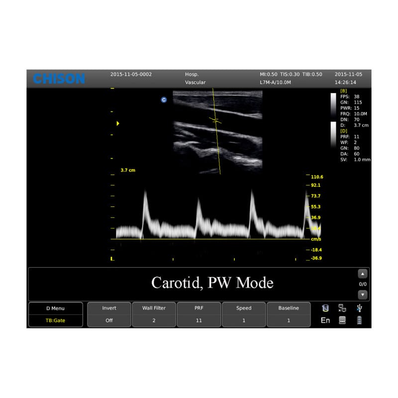 CHISON ECO3 Expert Ultrasound Machine with linear transducer (L7M-A) Medvana UK