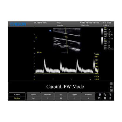 CHISON ECO3 Expert Ultrasound Machine with linear transducer (L7M-A) Medvana UK