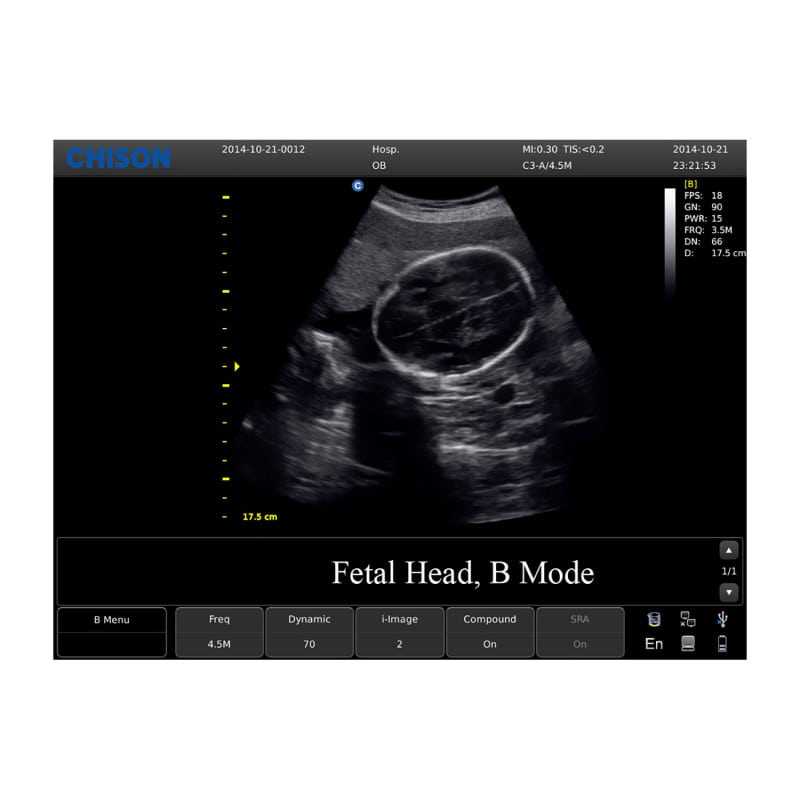 CHISON ECO3 Expert Ultrasound Machine with convex transducer (C3-A) Medvana UK