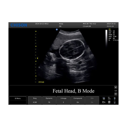 CHISON ECO3 Expert Ultrasound Machine with linear transducer (L7M-A) Medvana UK