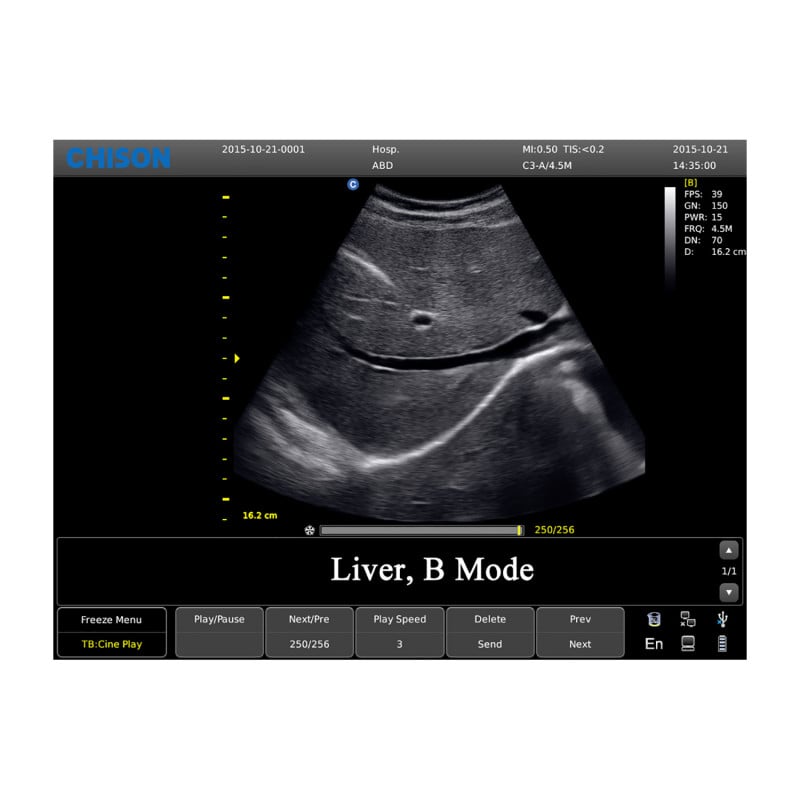 CHISON ECO3 incl. Ultrasound Trolley with convex probe Medvana UK