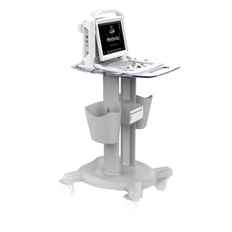 CHISON ECO1 incl. Ultrasound Trolley with battery | with convex probe ...