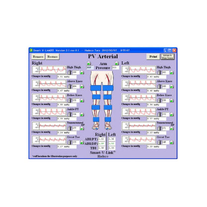 Smart-V-Link Software Medvana UK