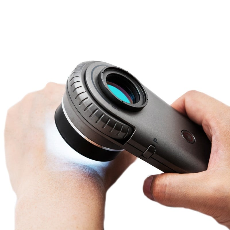 Illuco IDS-1100 Dermatoscope Medvana UK