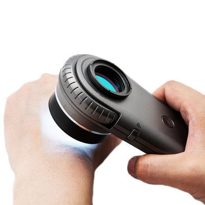 Illuco IDS-1100 Dermatoscope Medvana UK