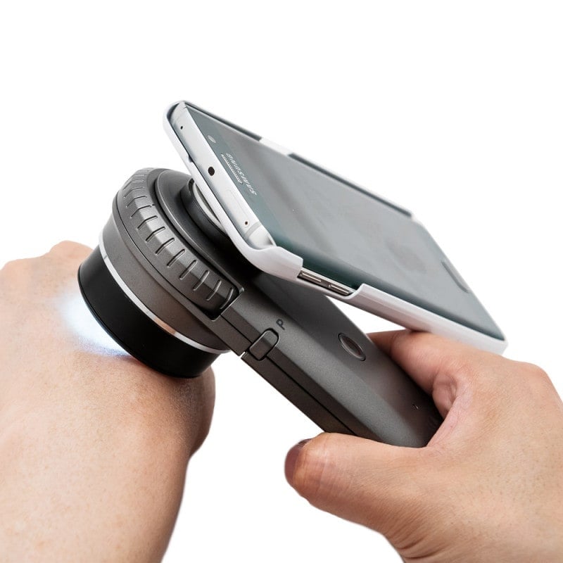 DermoScan Smartphone Adapter for iPhone 5, 5S, 5SE Medvana UK