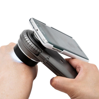 DermoScan Smartphone Adapter for iPhone 6 Plus Medvana UK