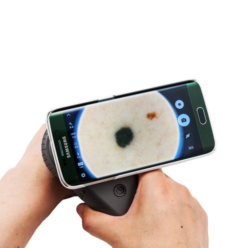 DermoScan Smartphone Adapter for Samsung Galaxy S6 Medvana UK
