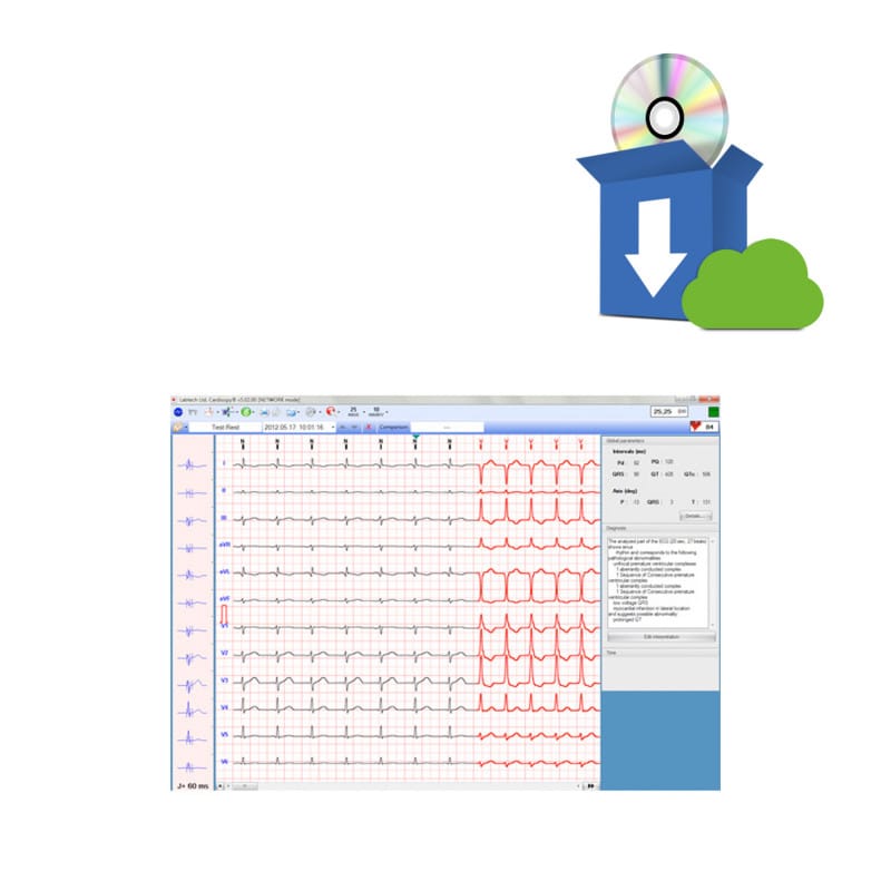 ECG-1000 ECG Management Software for Biocare Medvana UK