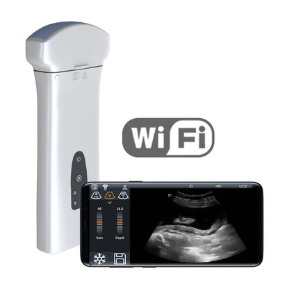 Youkey D8 Mobile Ultrasound Machine color | with linear transducer (L11-4Gs)
