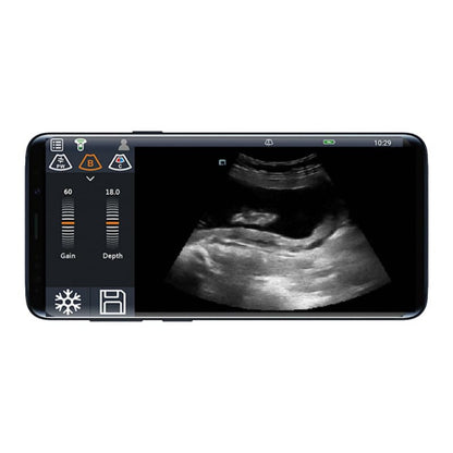 Youkey D8 Mobile Ultrasound Machine black-white | without transducer