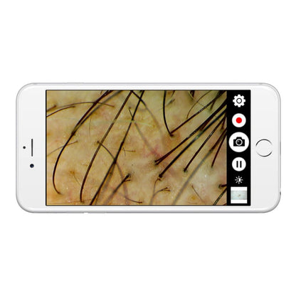 Firefly DE370 HD Mobile Wireless Polarizing Dermatoscope Medvana UK