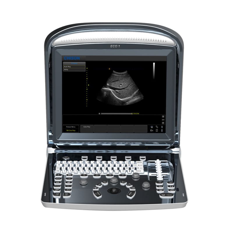 Chison ECO 1 Ultrasound Machine with rechargeable battery | convex tra ...