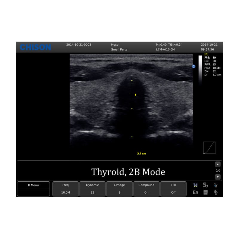 Chison ECO 1 Ultrasound Machine without rechargeable battery | convex transducer (C3-A) Medvana UK