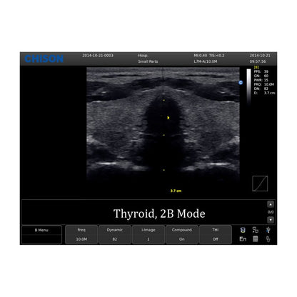 Chison ECO 1 Ultrasound Machine without rechargeable battery | linear transducer (L7M-A) Medvana UK