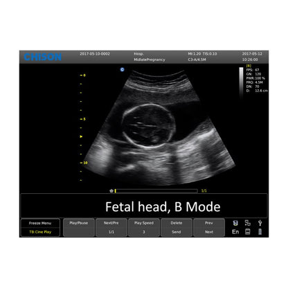 CHISON ECO6 incl. Ultrasound Trolley with convex probe Medvana UK