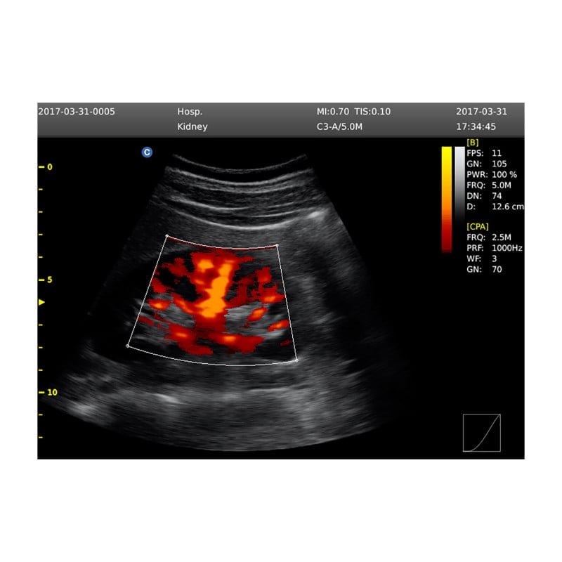 CHISON ECO6 incl. Ultrasound Trolley with convex probe & P3-A phased array probe Medvana UK