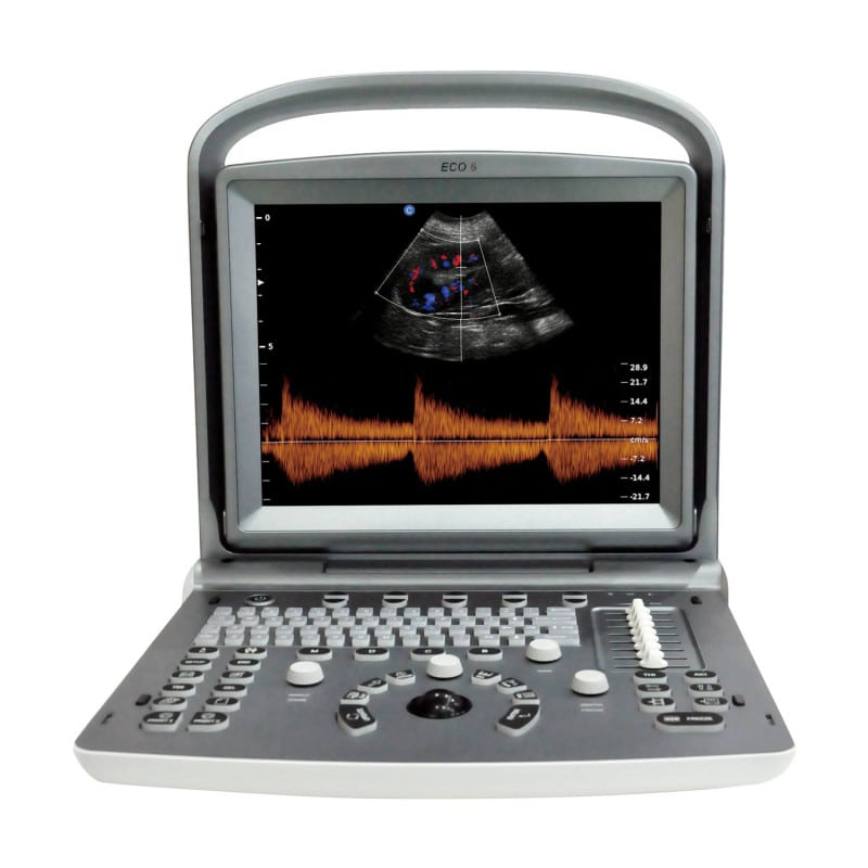 Chison ECO 6 Ultrasound Machine with C3-A convex transducer – Medvana