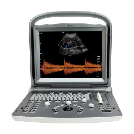 Chison ECO 6 Ultrasound Machine with C3-A convex transducer Medvana UK