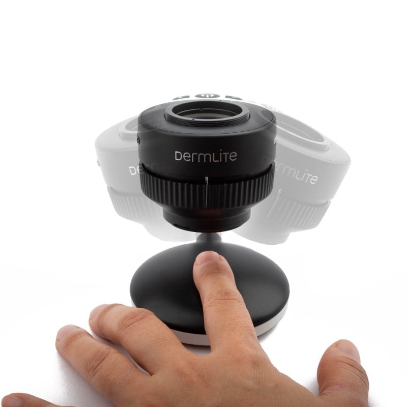 DermLite Foto X with Nailio Medvana UK