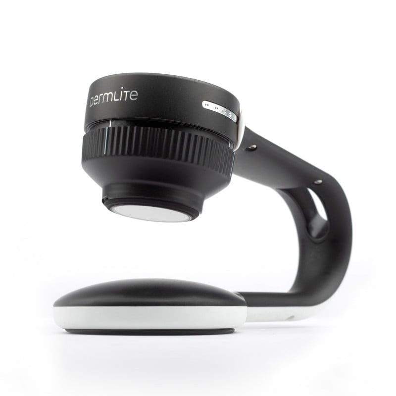 DermLite Foto X with Nailio Medvana UK