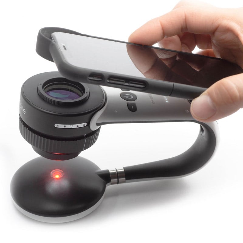 DermLite Foto X with Nailio Medvana UK