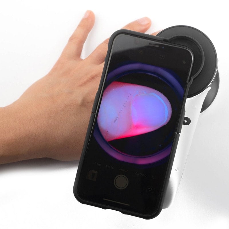 DermLite Foto X with Nailio Medvana UK