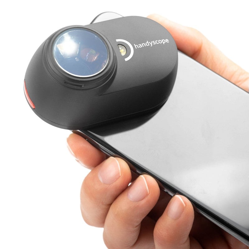 DermLite Handyscope Medvana UK