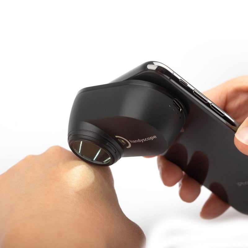 DermLite Handyscope Medvana UK