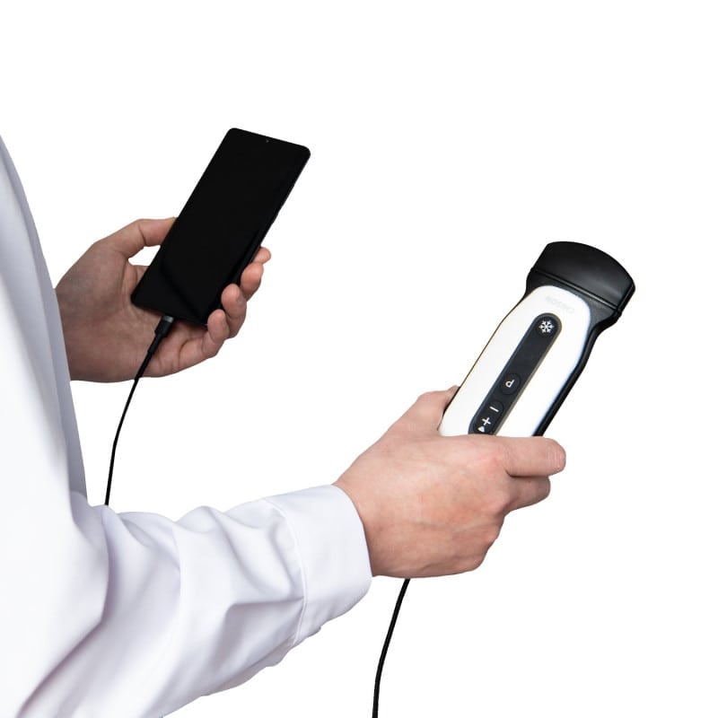 Chison Portable Ultrasound Machine “SonoEye” P7 (with 7.5 MHz linear rectal probe) Medvana UK