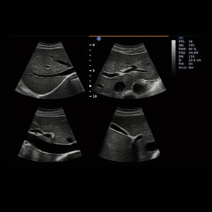 CHISON EBit 30 incl. Ultrasound Trolley with battery | with height adjustment Medvana UK