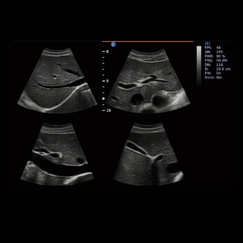 Chison EBit 30 Medvana UK