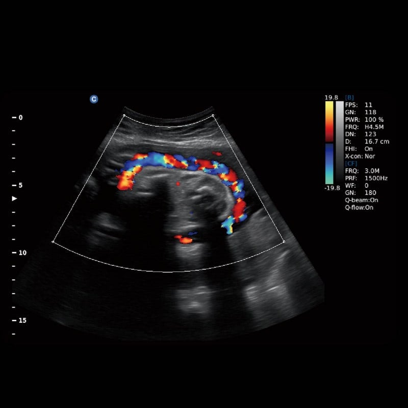 CHISON EBit 30 incl. Ultrasound Trolley with battery | without height adjustment Medvana UK