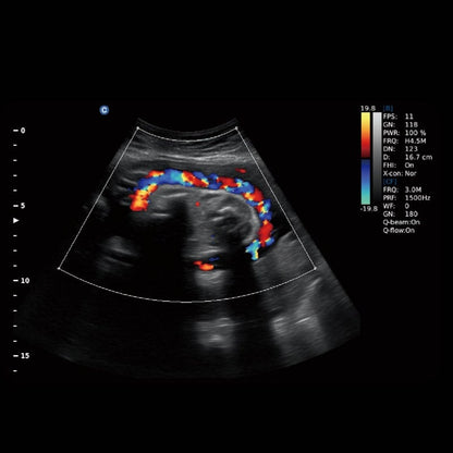 CHISON EBit 30 incl. Ultrasound Trolley with battery | without height adjustment Medvana UK