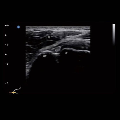 Chison EBit 30 Medvana UK