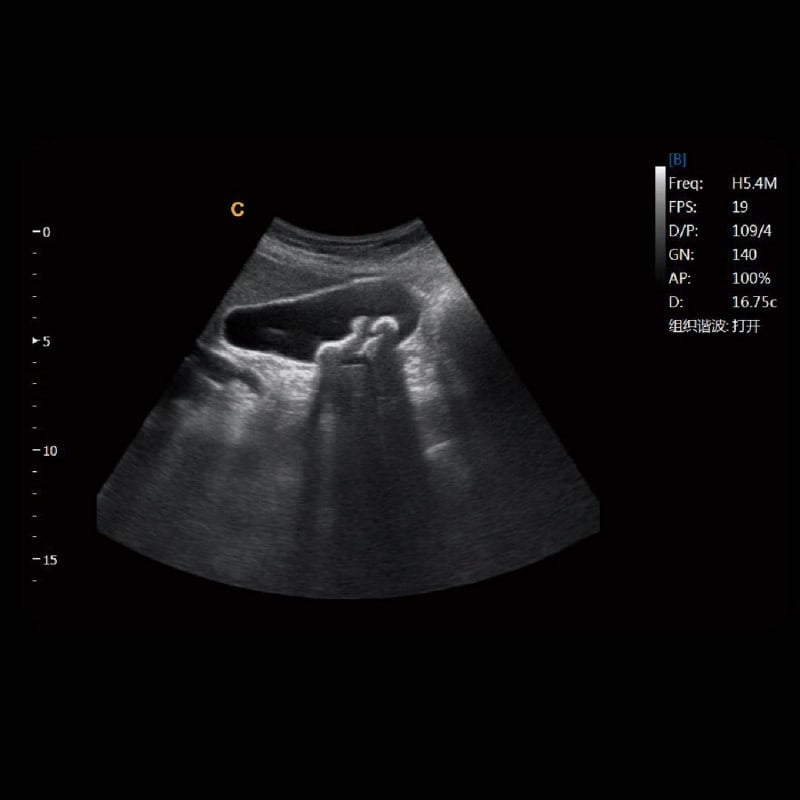 CHISON EBit 30 incl. Ultrasound Trolley with battery | without height adjustment Medvana UK