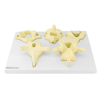 Model of Vertebrae Types Medvana UK