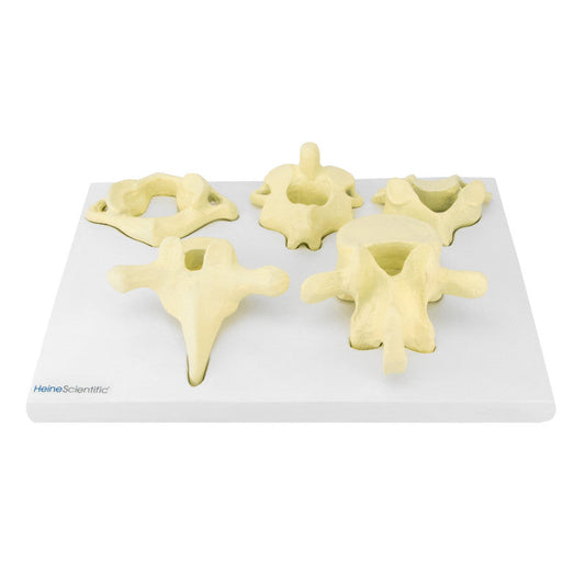 Model of Vertebrae Types Medvana UK