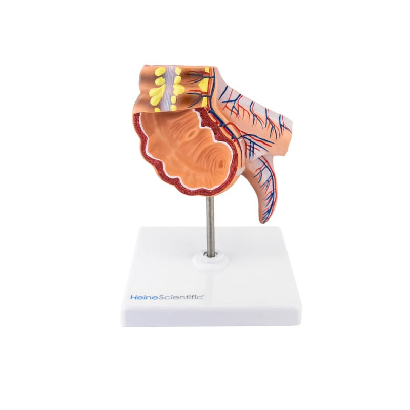 Appendix Model Kit Appendix Model – Medvana