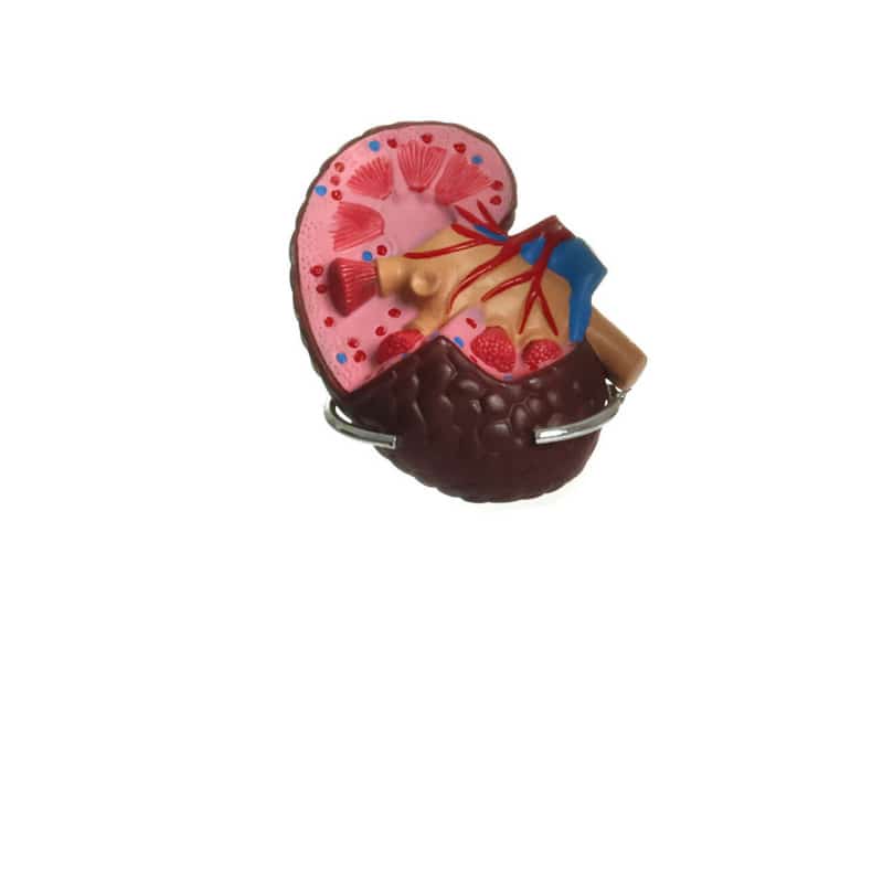 Hypertension Model Set Medvana UK