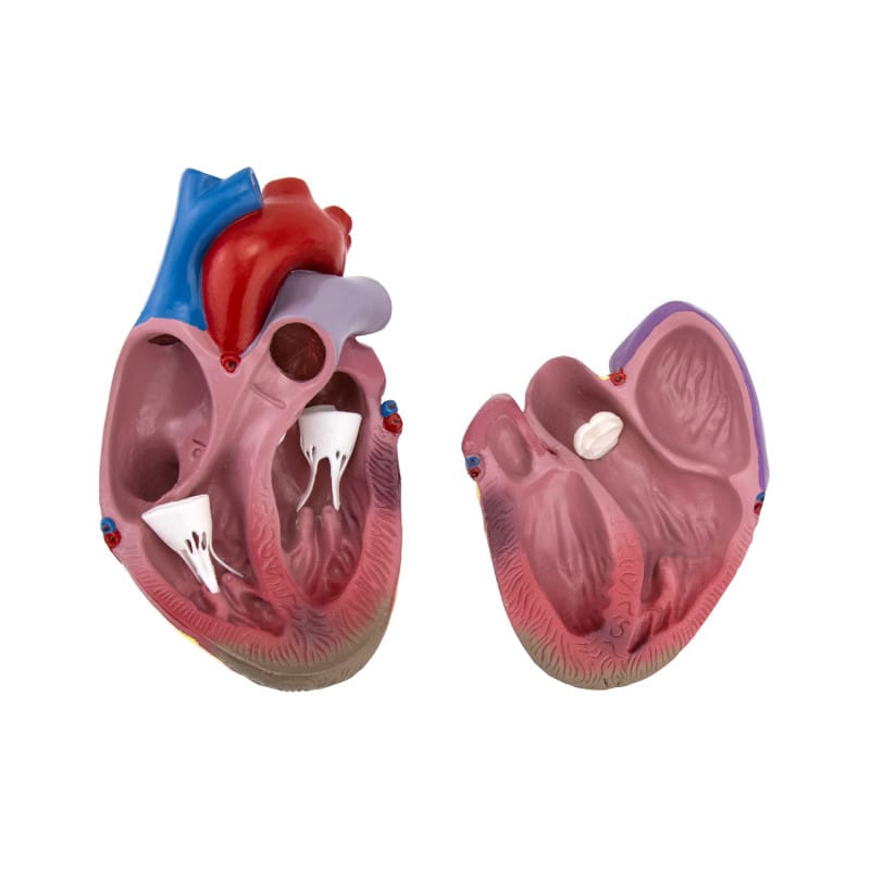 Model of Diabetes Secondary Diseases Medvana UK