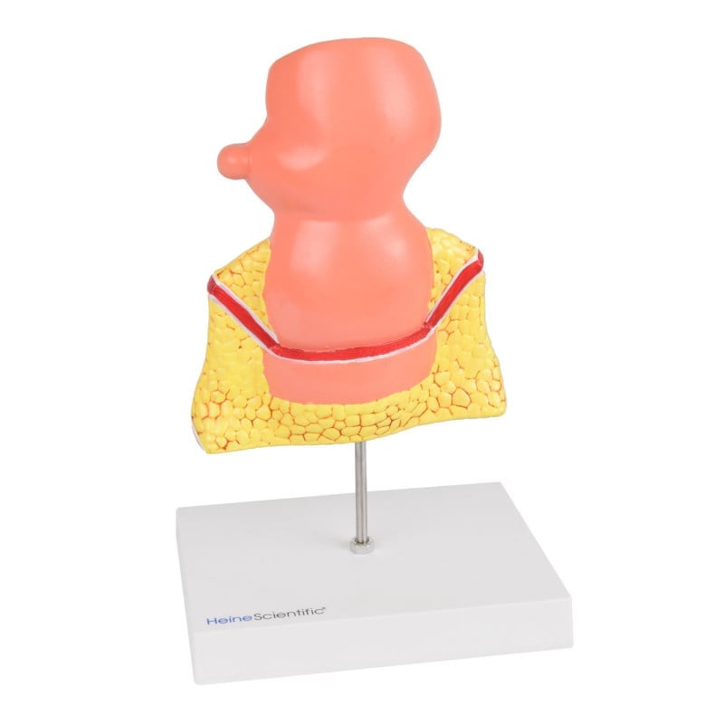 Rectum Model with Pathologies Medvana UK