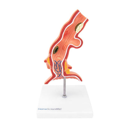 Oesophagus Model with Diseases Medvana UK