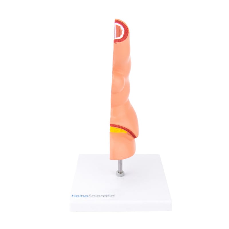 Oesophagus Model with Diseases Medvana UK