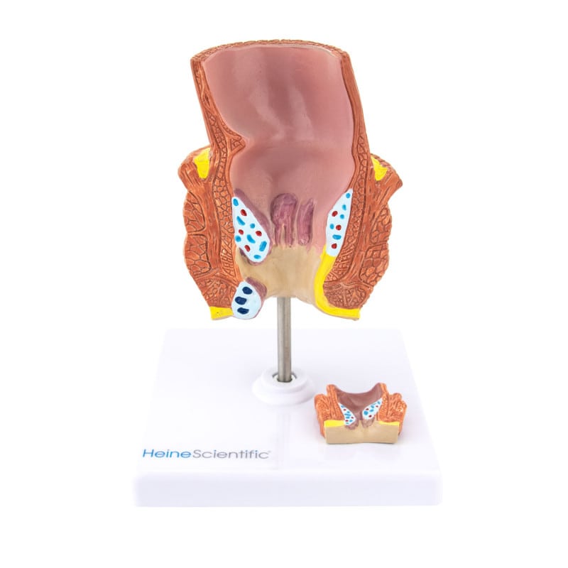 Haemorrhoid Model Medvana UK
