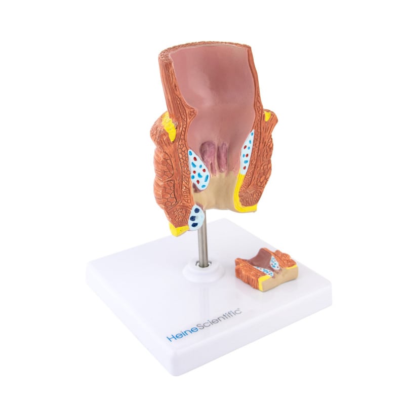 Haemorrhoid Model Medvana UK