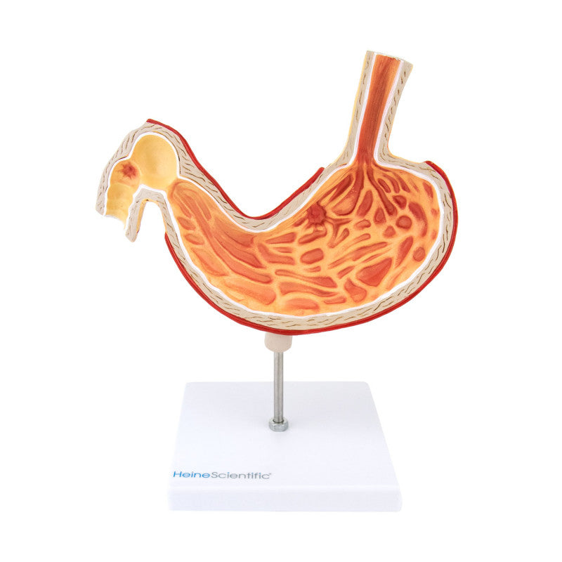 Stomach Model with Ulcers Medvana UK