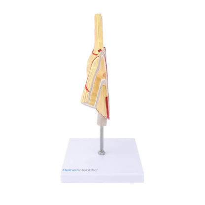 Stomach Model with Ulcers Medvana UK